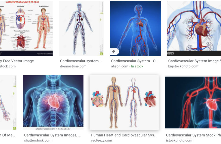 COVID IS A VASCULAR DISEASE